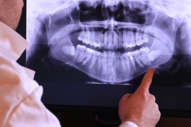 Best Emergency Dental Care for Broken or Chipped Teeth in Thruston, KY