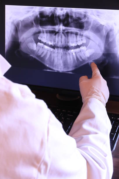 Best Emergency Wisdom Teeth Removal in Thruston, KY
